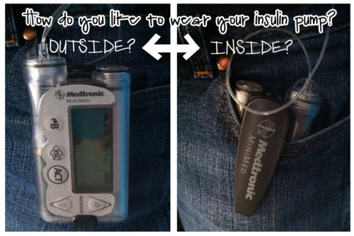 How do you like to wear your insulin pump?