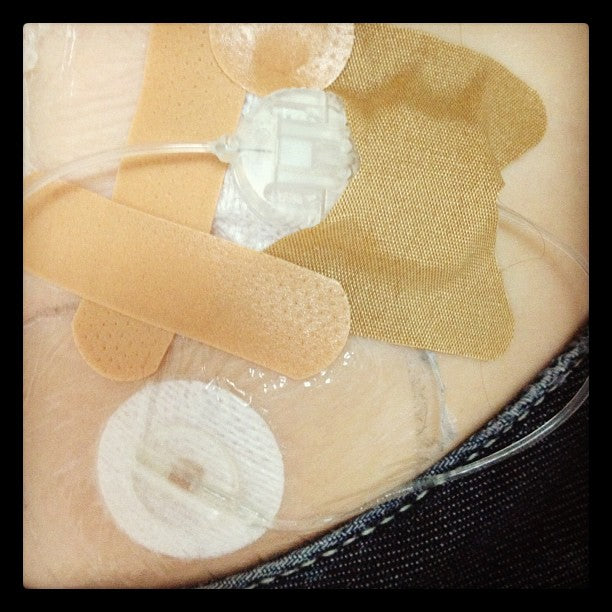 An Unhappy Pump Site